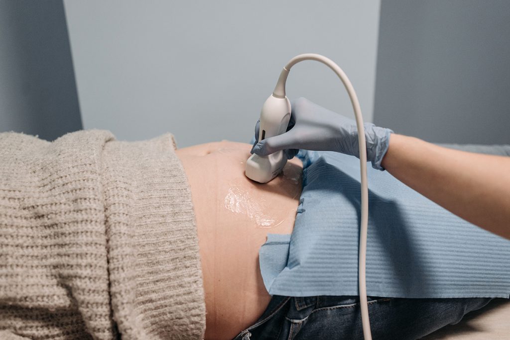 Photo d'un ventre de emme enceinte passant une échographie de dépistage.